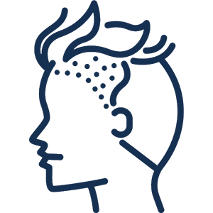 Tıraşsız Saç Ekimi